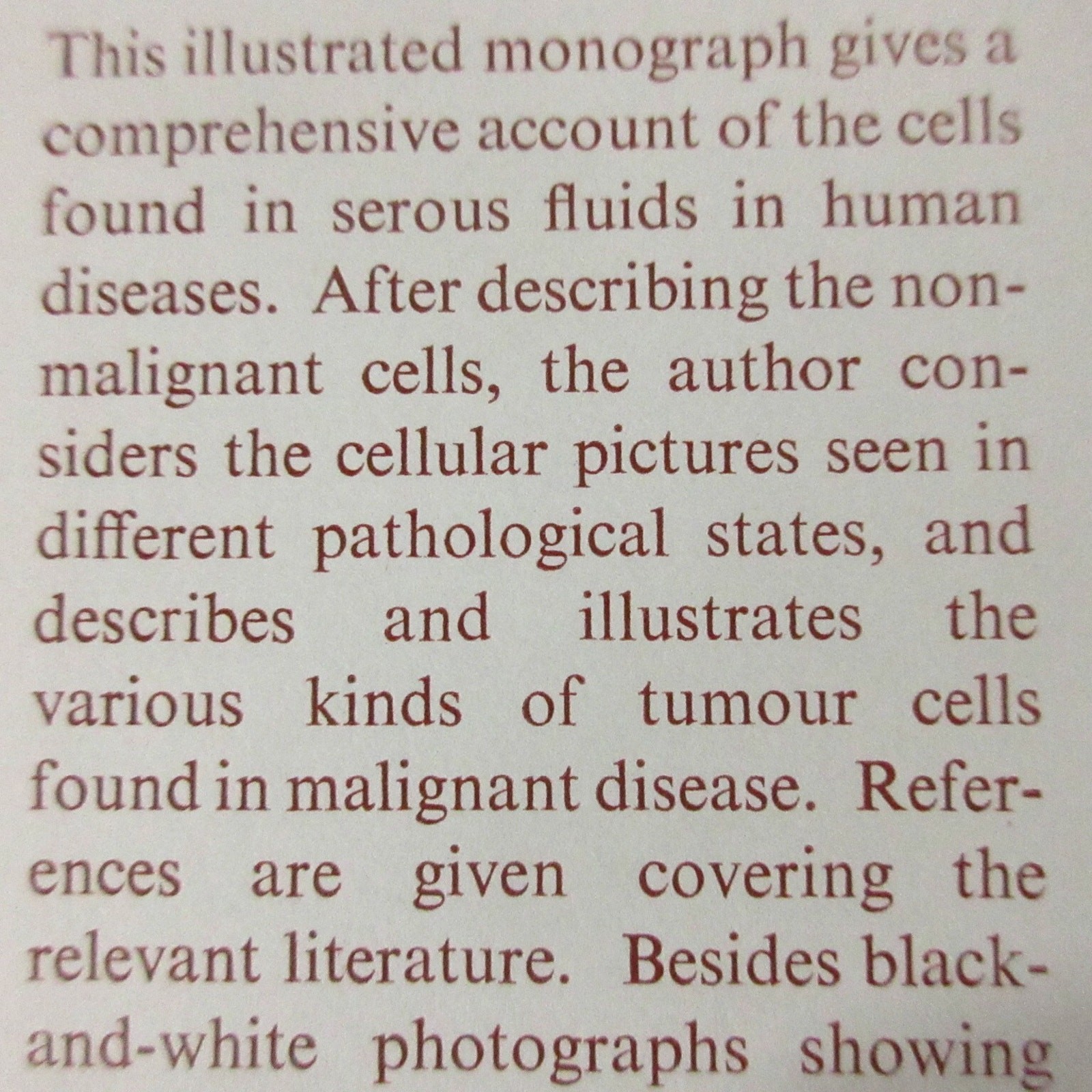 Vintage Medical Book Cancer Pathology Cytology of Effusions Spriggs Color Plates