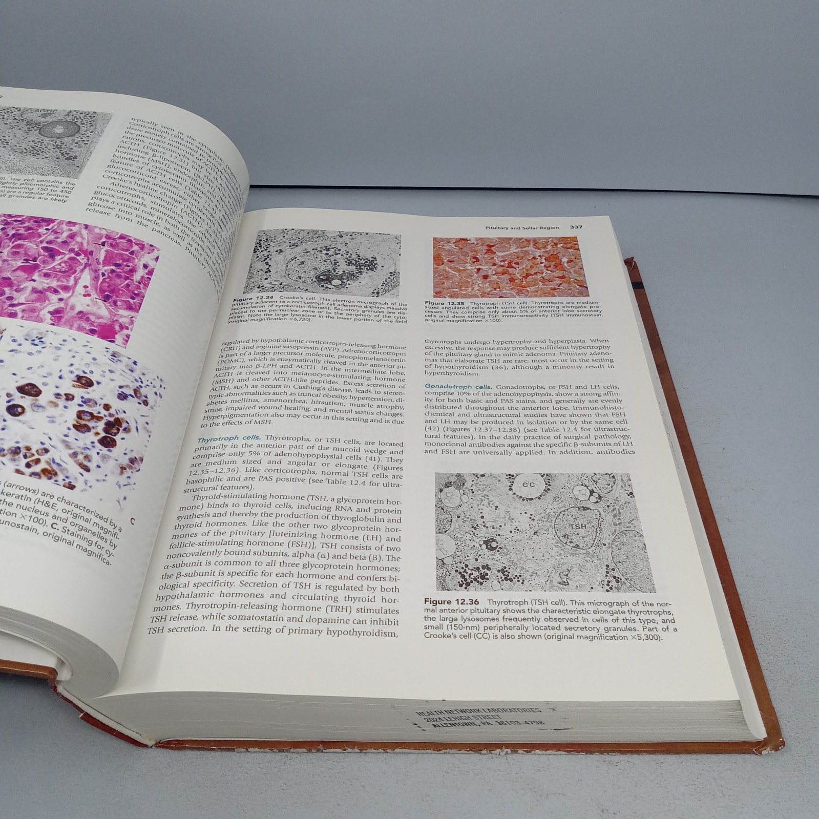 Histology for Pathologists: 3rd Edition 2007 Hardcover by Stacey E. Mills